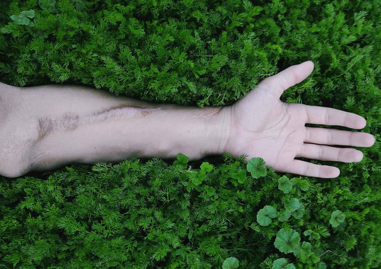 Falta de repasse Goiânia