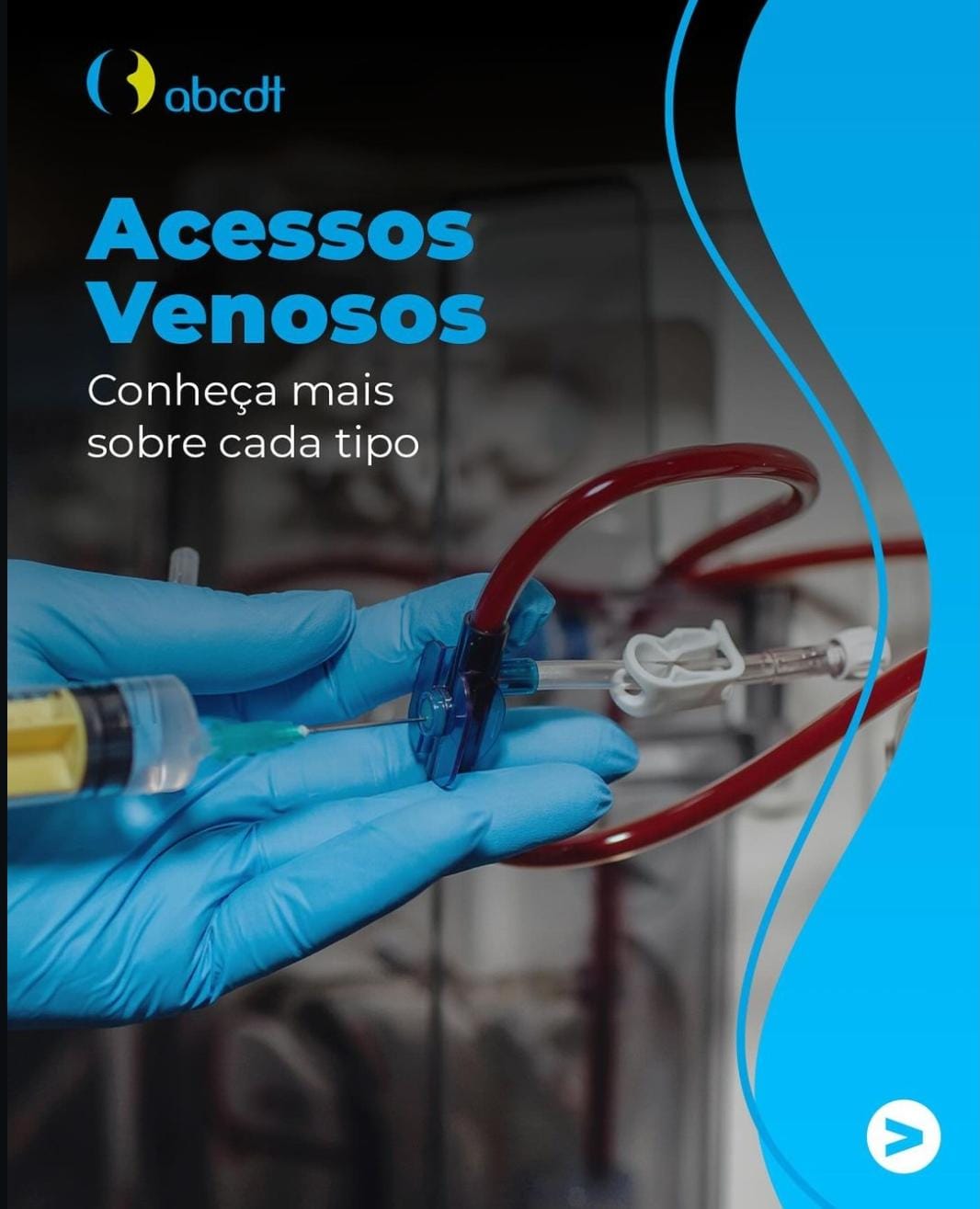 acessosvenosos
