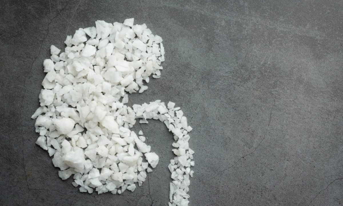 Pedras nos rins 30% dos pacientes podem ter insuficiência renal crônica