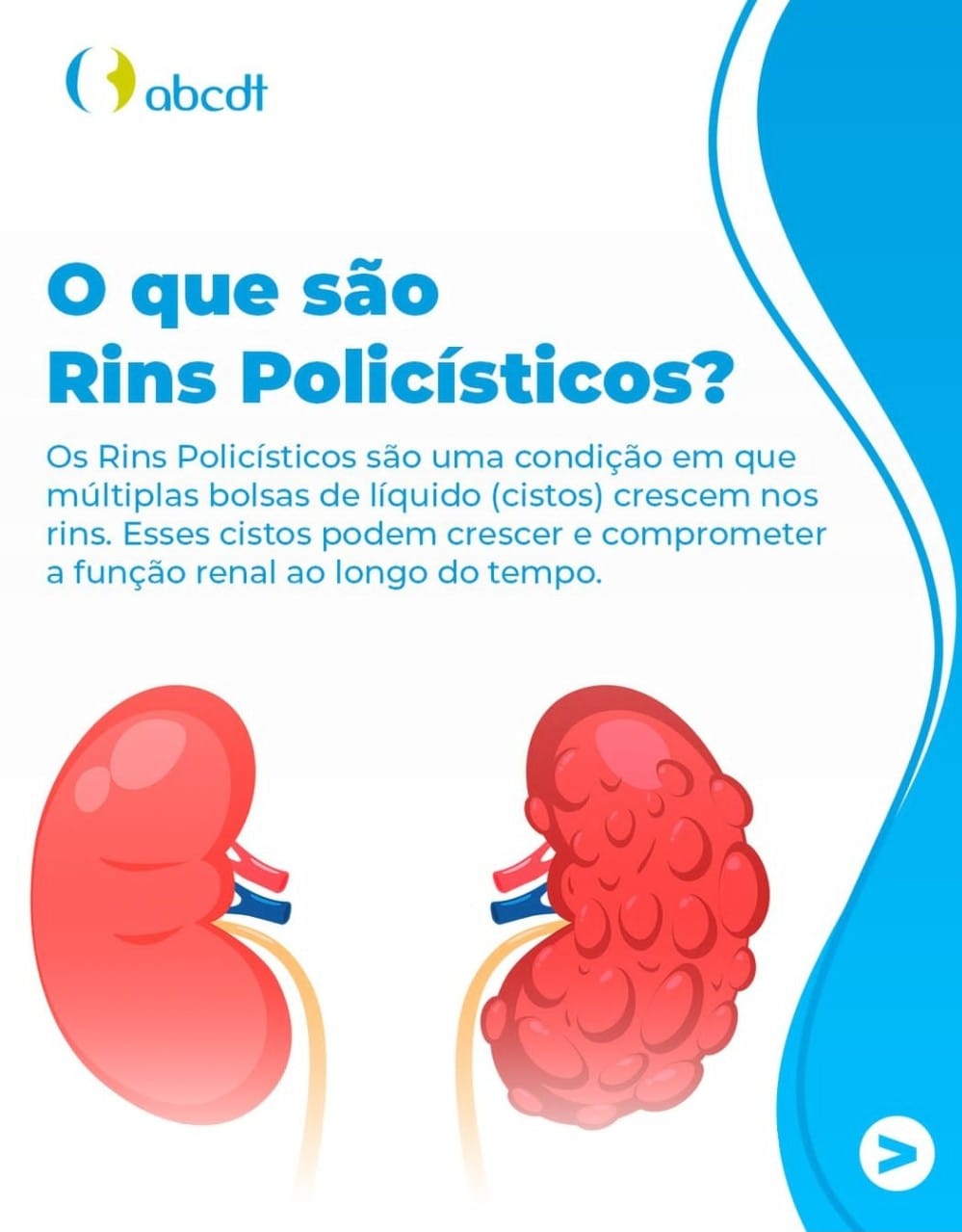 O que são Rins Policísticos
