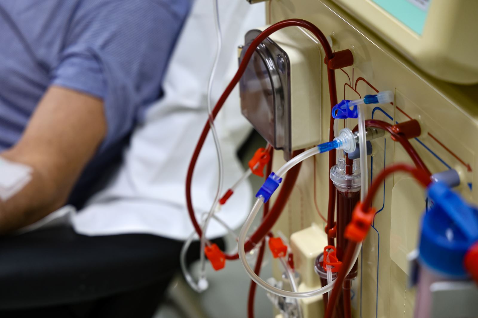 ​Estado amplia investimentos para melhorar tratamento a pacientes renais em SC