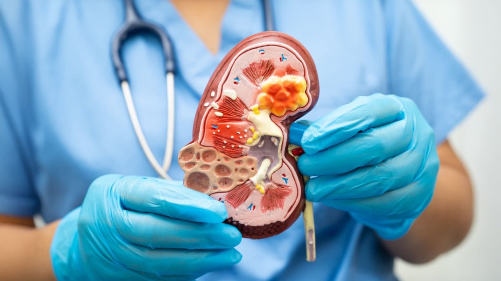 CPN 2025 Doença renal crônica e alterações climáticas chave para inflamação