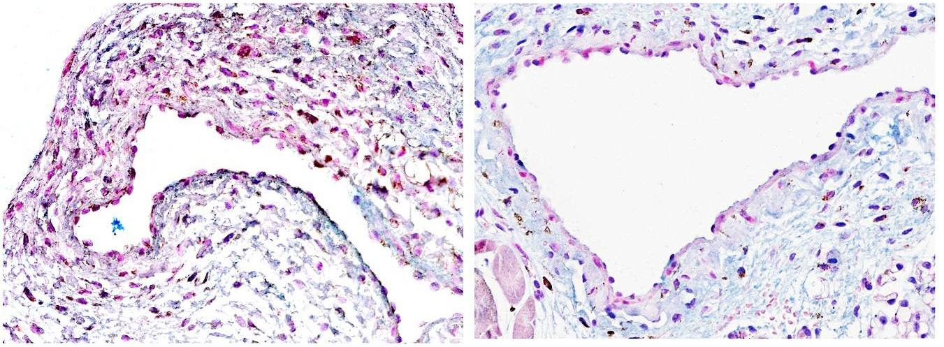 Células-tronco podem oferecer uma nova esperança para o tratamento da doença renal em estágio terminal
