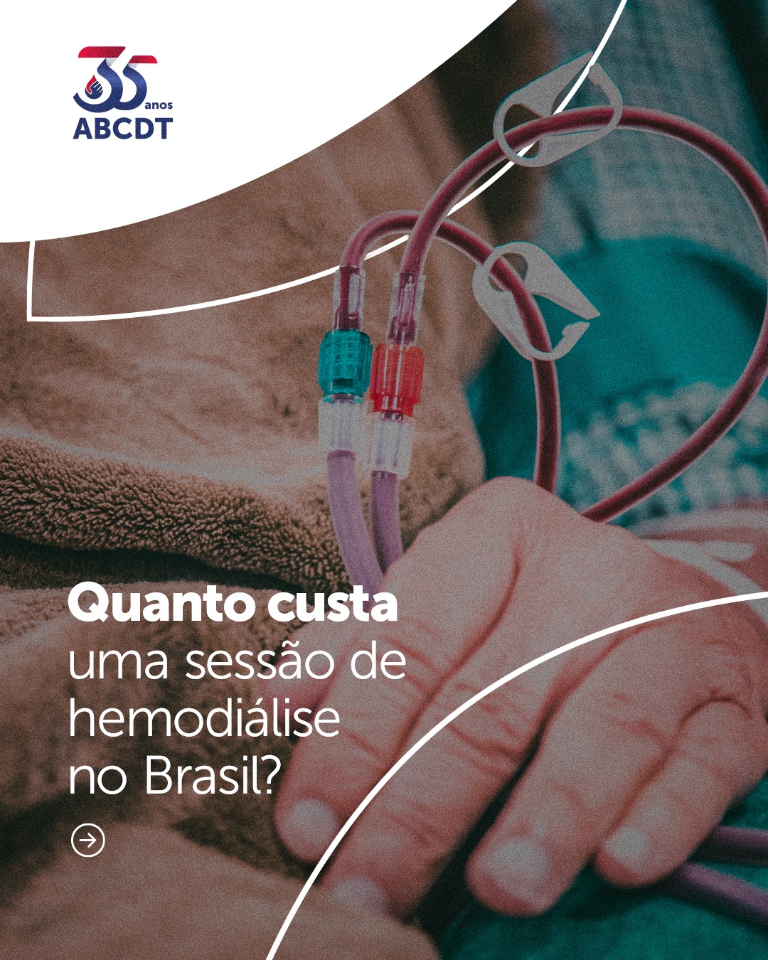 Quanto custa uma sessão de hemodiálise no Brasil