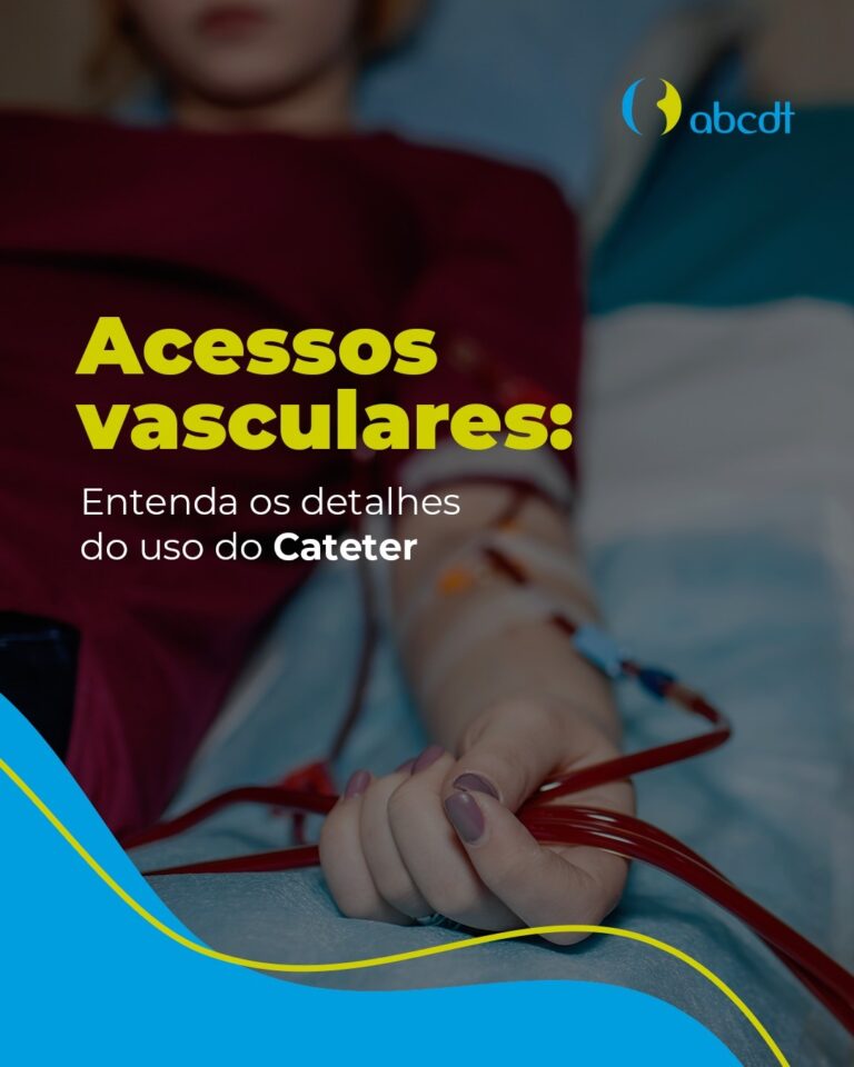 Acessos vasculares: Entenda os detalhes do uso do Cateter